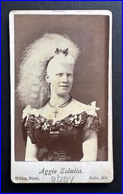 Aggie Zolutia Albino Mind Reader Albino Girl Circus Sideshow Freak CDV #1