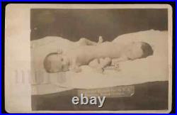 Amazing Rare Cabinet Card Photo of Conjoined Twins / 1889