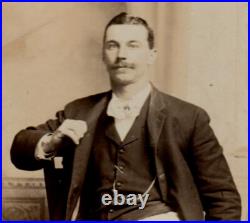 Antique DEFORMED CIRCUS FREAK Rare HUMAN-FROG PHOTO Sideshow Oddity TWISTED BODY