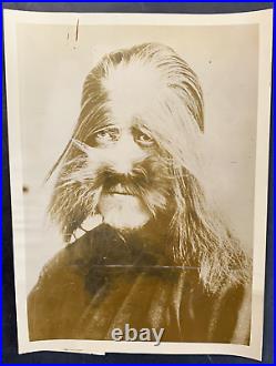 Antique Vintage Sideshow Carnival Circus Freak Photo of The Lion Faced Man 1930s