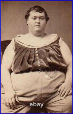 BEAUTIFUL Antique FREAK PHOTO Rare Historic CIRCUS FAT MAN 1870 Sideshow History