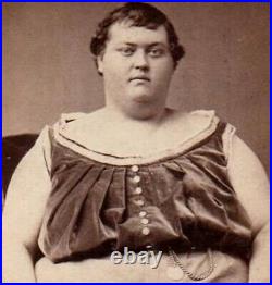 BEAUTIFUL Antique FREAK PHOTO Rare Historic CIRCUS FAT MAN 1870 Sideshow History
