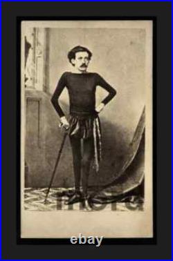 CDV Photo Unknown Sideshow Freak Skeleton Man &/or Medical Curiosity RARE
