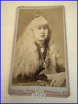 CDV of Albino Girl a Circus Performer by Photographer Eisenmann