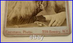 CDV of Albino Girl a Circus Performer by Photographer Eisenmann