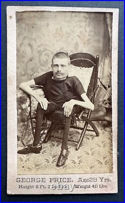 George Price The Living Skeleton- Scarce CDV of a Circus Sideshow Freak