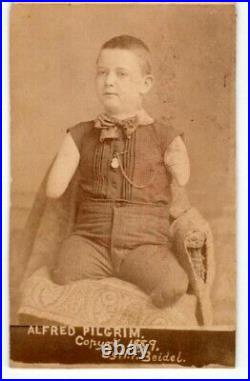 LIVING HUMAN TORSO Rare ANTIQUE 1889 CIRCUS FREAK PHOTO Sideshow LEGLESS ARMLESS