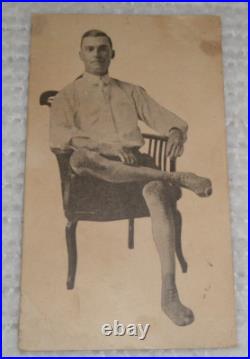 Ralph The Elephant Skin Man SIGNED Original Antique Circus Sideshow Freak Card