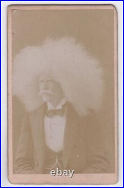 Unzie Aborigine Albino Barnum Circus Side Show Man Vaudeville Antique CDV Photos