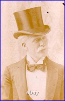 Unzie Aborigine Albino Barnum Circus Side Show Man Vaudeville Antique CDV Photos