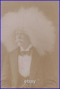 Unzie Aborigine Albino Barnum Circus Side Show Man Vaudeville Antique CDV Photos