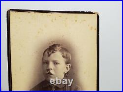 Vintage Medical Oddity Cabinet Card Photo Freak Disfigured Boy Cleft Palate Rare